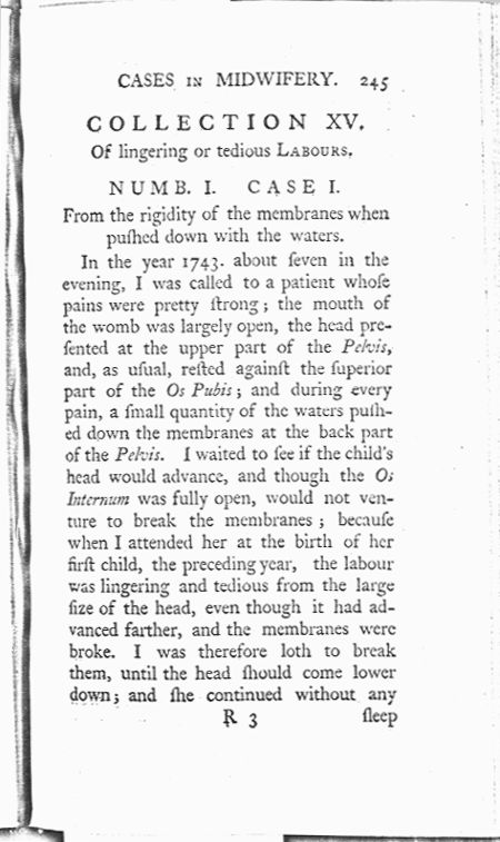 A Collection of Cases and Observations in Midwifery (Volume Two) Page 245. Choose 'View Text' (at top) for faster download.