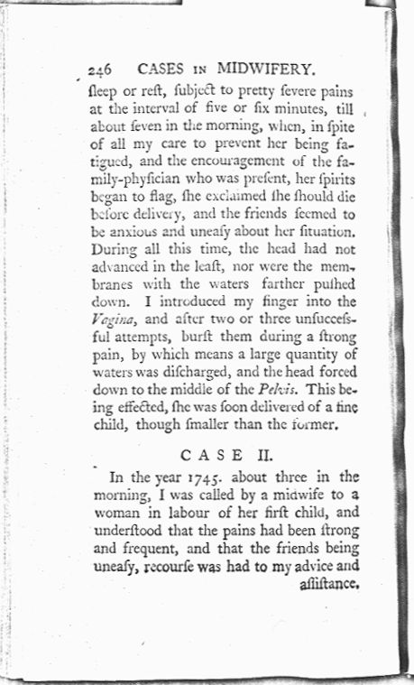 A Collection of Cases and Observations in Midwifery (Volume Two) Page 246. Choose 'View Text' (at top) for faster download.