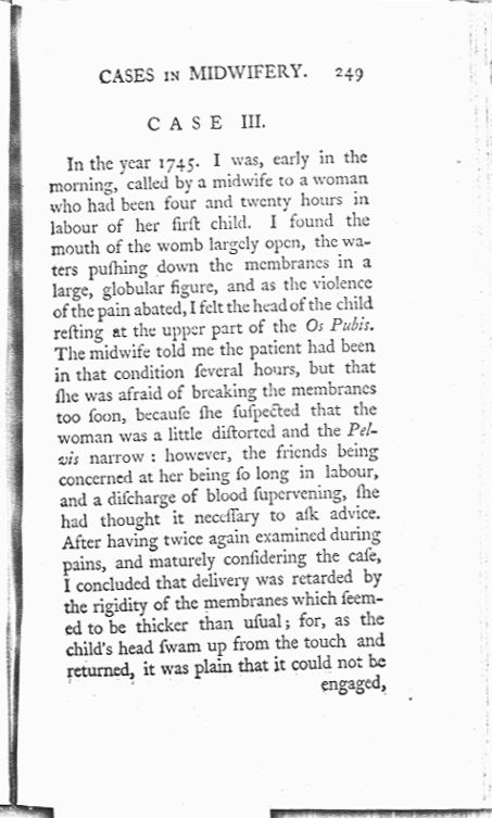 A Collection of Cases and Observations in Midwifery (Volume Two) Page 249. Choose 'View Text' (at top) for faster download.