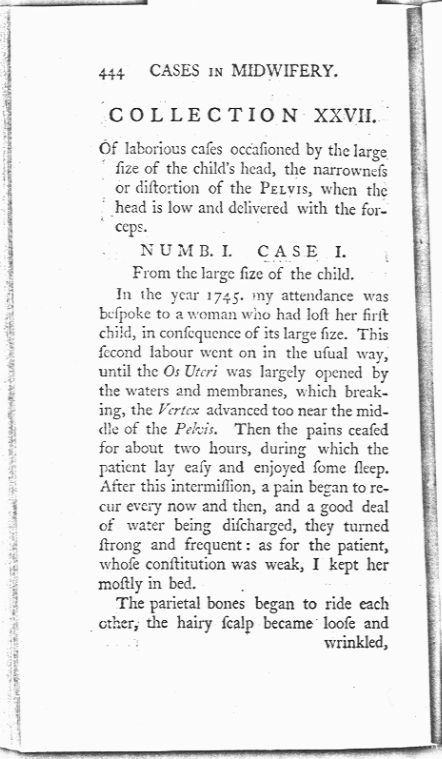 A Collection of Cases and Observations in Midwifery (Volume Two) Page 444. Choose 'View Text' (at top) for faster download.