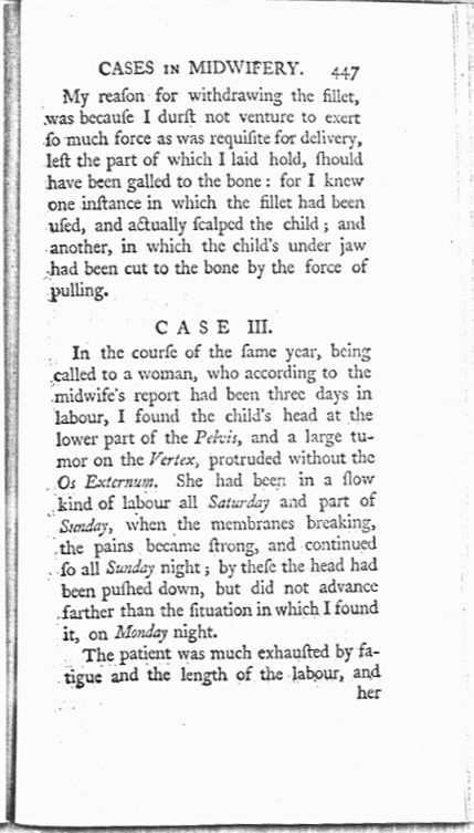 A Collection of Cases and Observations in Midwifery (Volume Two) Page 447. Choose 'View Text' (at top) for faster download.