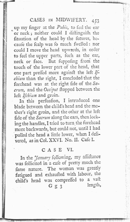A Collection of Cases and Observations in Midwifery (Volume Two) Page 453. Choose 'View Text' (at top) for faster download.